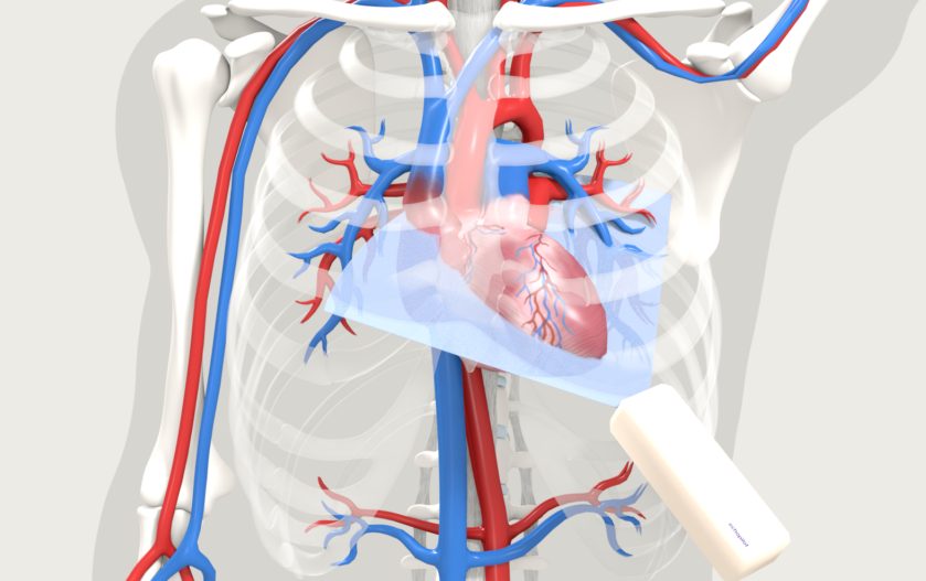 Lage der echokardiographischen Schnittebene im Thorax